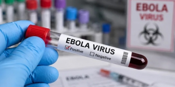 doktorlardan_ebola_salginina_karsi_ulusal_eylem_plani_cagrisi_h91367_03c84.jpg
