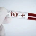 hiv-pozitif.webp.webp