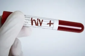 hiv-pozitif.webp.webp