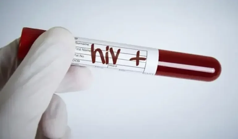 hiv-pozitif.webp.webp